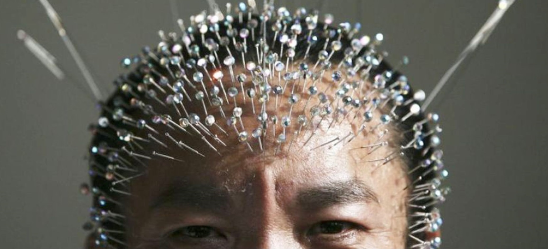 Люди, которые не чувствуют боль