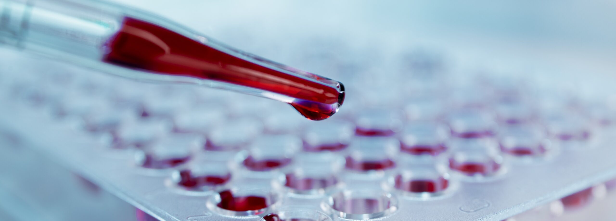 Простой тест предскажет риск болезни Альцгеймера на 20 лет вперед