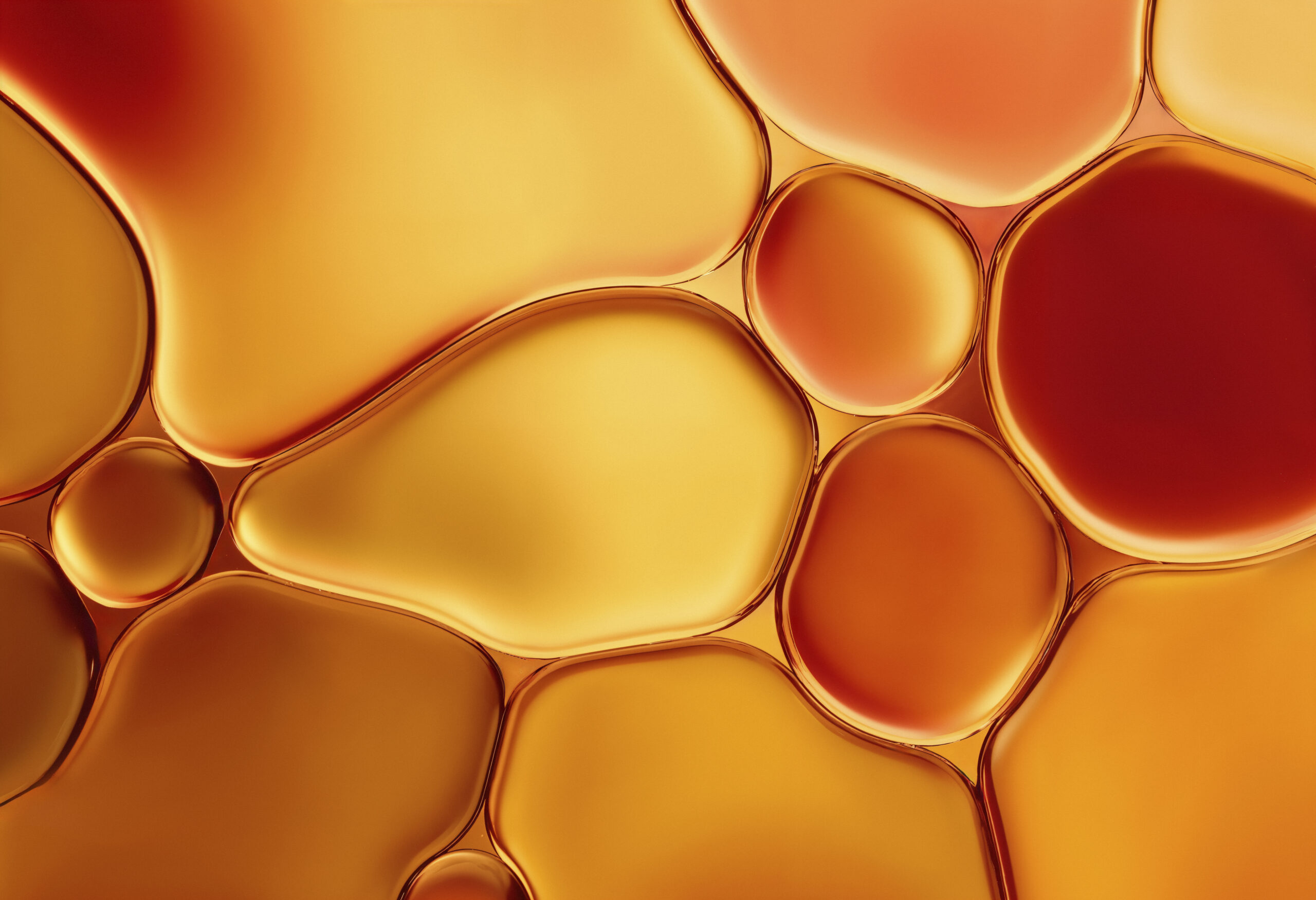 Adipose tissue may cause anxiety