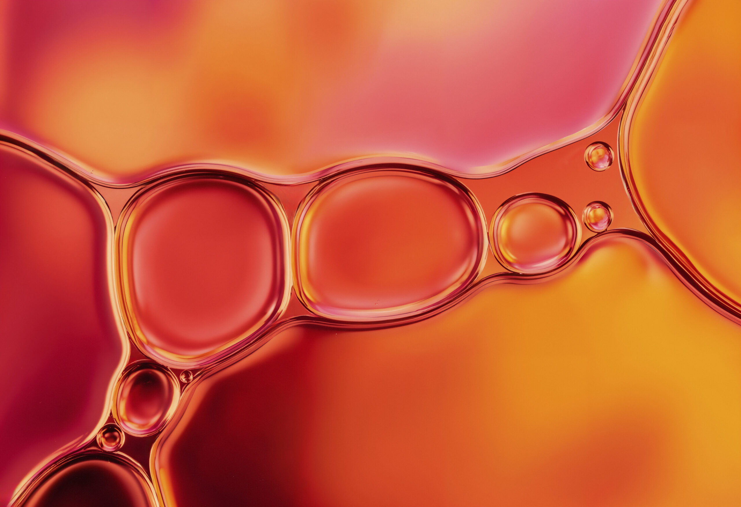 Possible markers of chronic fatigue have been found in the blood